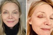 Michelle Pfeiffer person black eye incident 